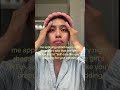 #acne #skin #skincare