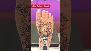 Crazy Doctor Surgery Game 🏥 Doctor#doctors #doctor #surgeon #surgery #subscribe #support #foryou