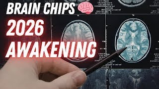 RISE OF MACHINES, BRAIN CHIPS IN 2026