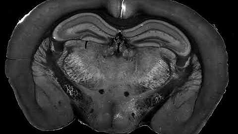 Sections through Mouse Brain acquired by Two-Photon Microscopy