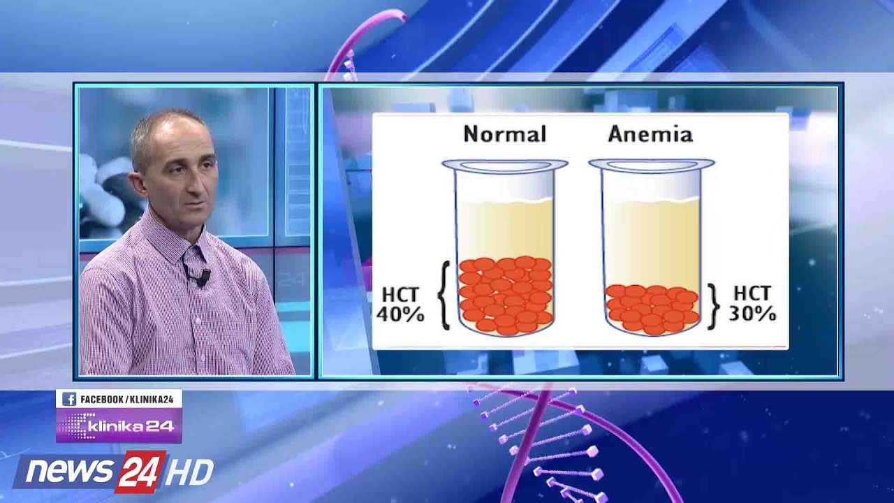 Anemia, si të trajtohet siç duhet... Ja çfarë rekomandon mjeku...