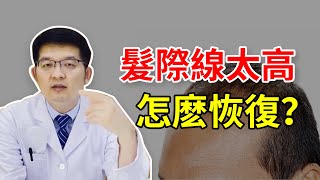【植髮醫生徐魯35】髮際線太高有救了？種植髮際線直觀、有效！