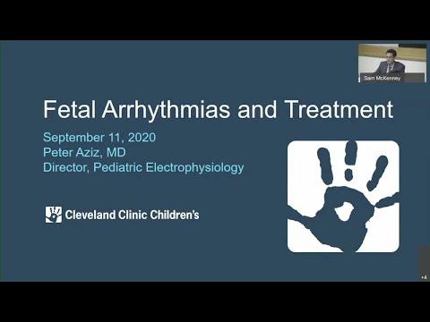 Video: Sinus Arrhythmia - Treatment In Children And During Pregnancy