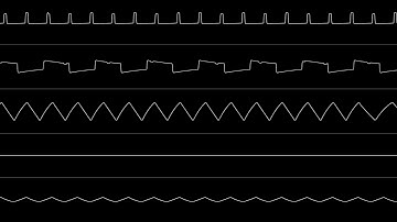 Burnt Fishy - "Tiny Mod 3" [2A07 PAL NES 8-bit FamiTracker Remix]