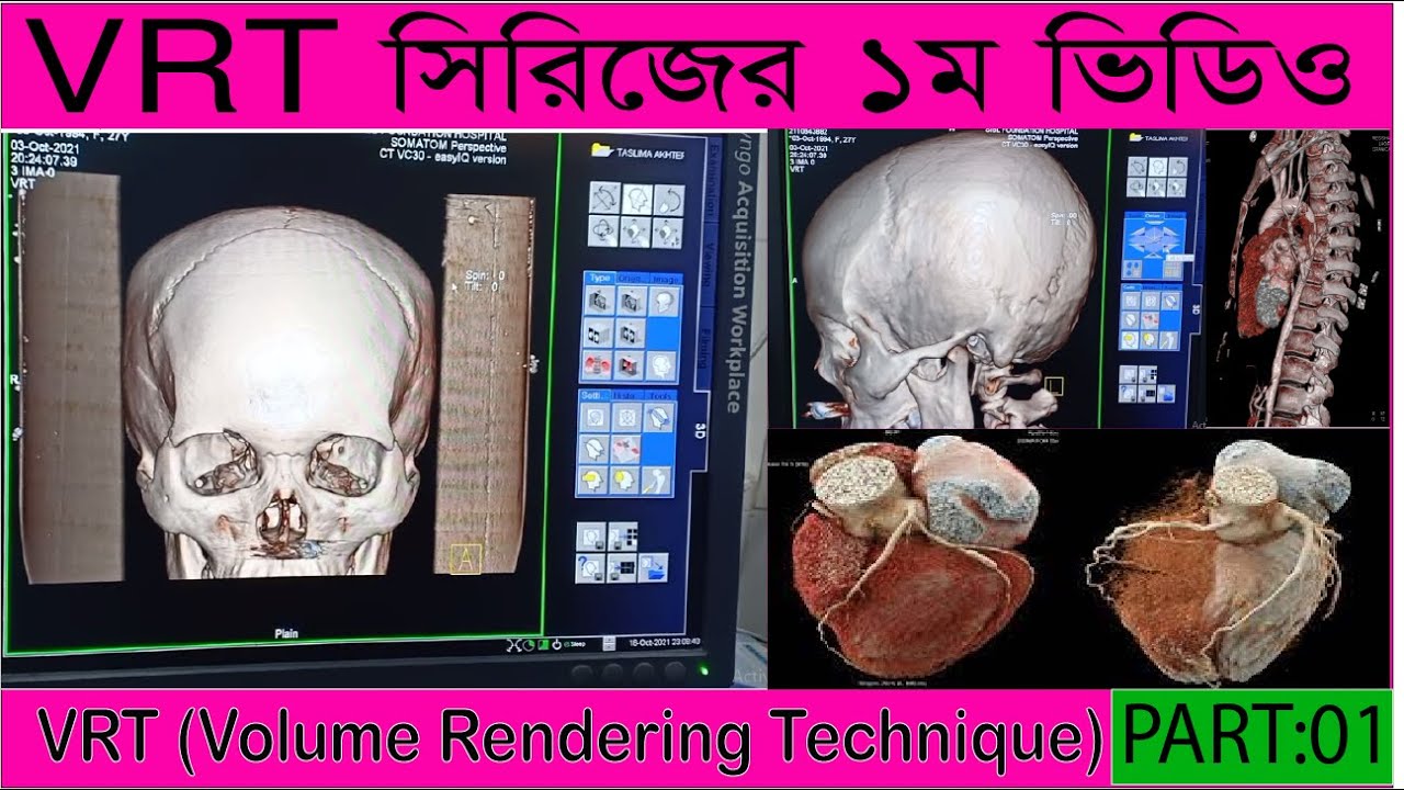 Video No:012. Learning Volume Rendering Technique (VRT) 1st Part. CT ...
