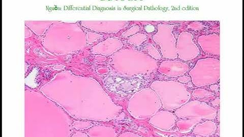 LEC 8 MÔ BỆNH HỌC TUYẾN GIÁP