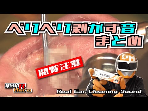 【ASMR】本物耳かき音 カピカピ耳をぺリぺリ剥がす音まとめ Real Ear Cleaning Sound  /TASCAM DR-07MK2/no talking【液体絆創膏】