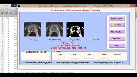 Matlab Project on Prostate Cancer Detection using Image Processing