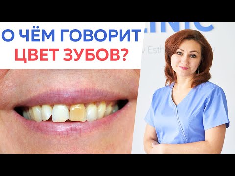 ТОП-6 причин изменения цвета зубов / О чем говорят ваши зубы?