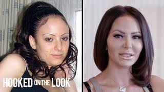 Plastic Surgery Addict Spends $130,000 To Look 'Perfect' | HOOKED ON THE LOOK