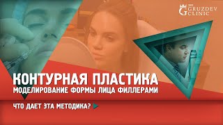 Контурная пластика лица с помощью филлеров на основе гиалуроновой кислоты