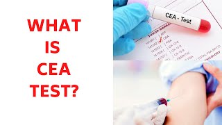 WHAT IS CEA BLOOD TEST?: Carcinoembryonic Antigen Test Levels- CEA Blood Test Meaning