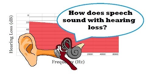 How Does Speech Sound with Hearing Loss?