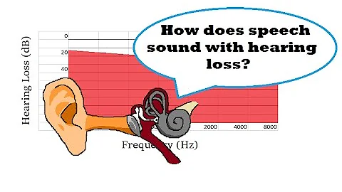 How Does Speech Sound with Hearing Loss?