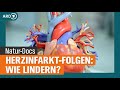 Herzinfarkt-Folgen lindern: Atemtherapie, Ernährung und Bewegung | NDR