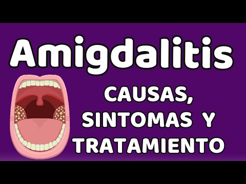 Video: ¿Se aclarará la amigdalitis por sí sola?