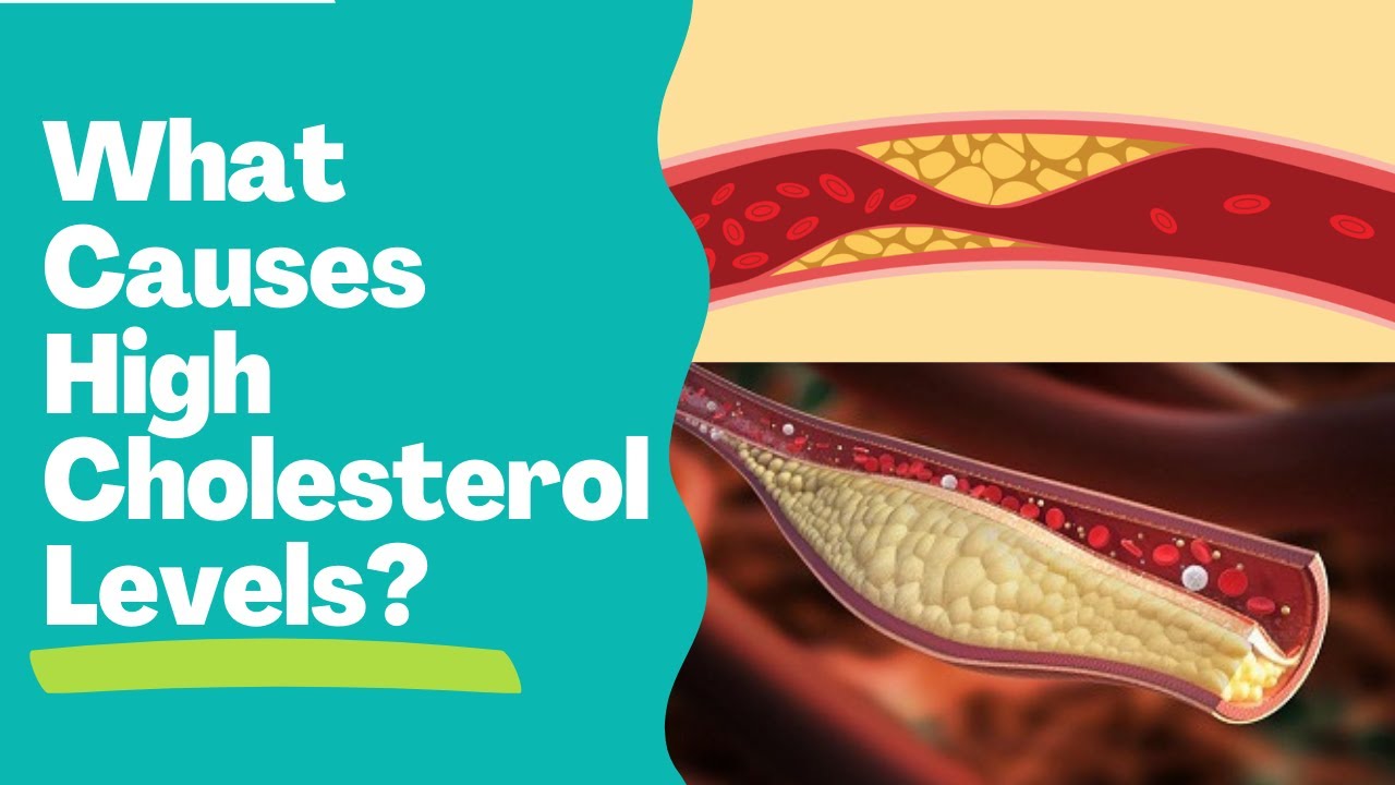 What Causes High or Abnormal Cholesterol Levels? Whitelane_Healthcare YouTube