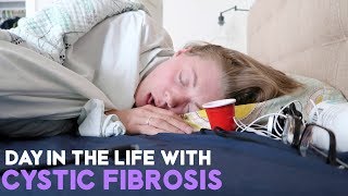 DAY IN THE LIFE WITH CYSTIC FIBROSIS | COUGHING, EXERCISE, FEVER & FEEDING TUBE! (8.2.17)