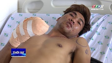 NÁT TAY VÌ ĐIỆN THOẠI NỔ TRONG LÚC VỪA SẠC PIN VỪA SỬ DỤNG