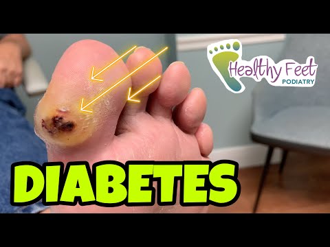 Video: Diabetes Læger: Øjenlæge, Podiatrist, Diætist Og Mere