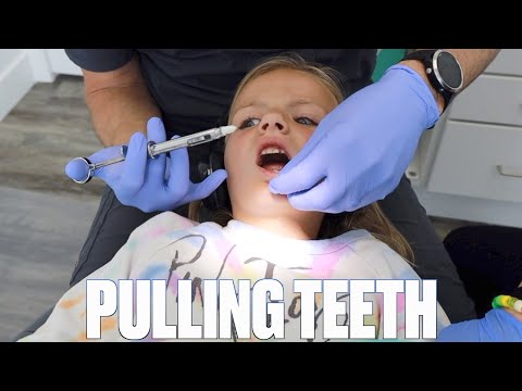 પીડાદાયક દાંત નિષ્કર્ષણ | દંત ચિકિત્સક પાસે ત્રણ દાંત ખેંચવા
