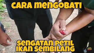 Pertolongan Pertama Saat Terkena Patil Ikan Sembilang