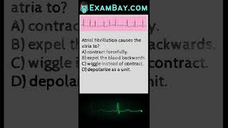 EKG\ECG Interpretation Practice Exam for Nursing NCLEX