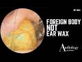 Leopard Print Ear Wax Removal?! - EP1241