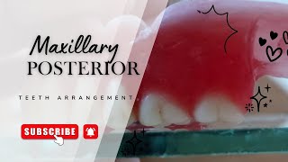 Maxillary Posterior Teeth Arrangement | Complete Step-by-Step Demonstration | Complete Denture 