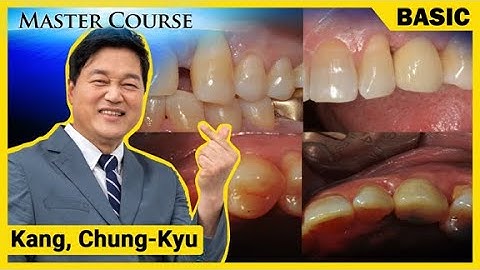 [Master Course Season2 - BASIC] Immediate implant placement