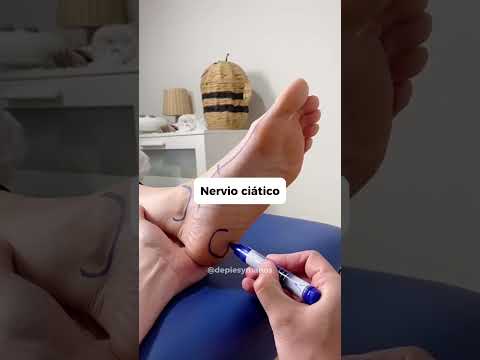 Cómo Aliviar el