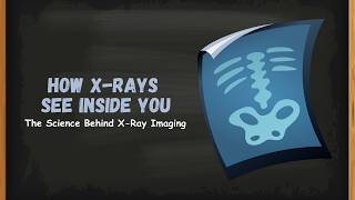 X-Rays Explained | How X-Ray Imaging Works