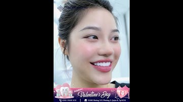 NỤ CƯỜI TƯƠI SÁNG, RẠNG RỠ TƯƠNG LAI  #rangsuthammy #nhakhoaaumy #nhakhoauytin #lamdep #nhakhoa