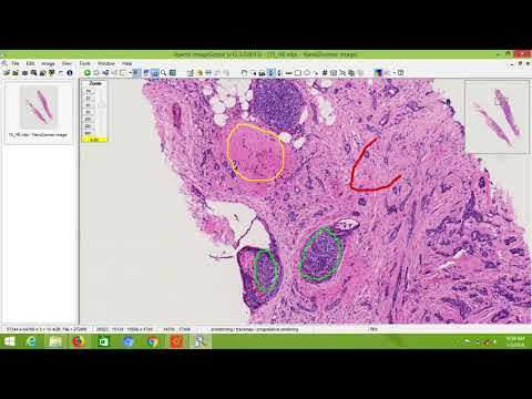 Image Annotation Using