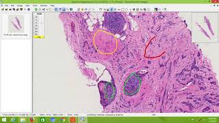 Image Annotation Using Image Scope