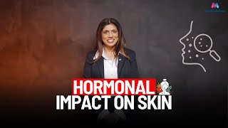 The Impact of Hormones on Your Skin |  Dr Sue