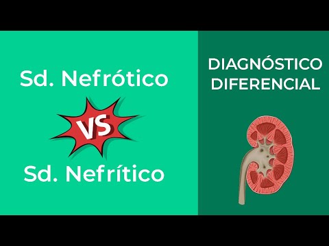 Vídeo: Diferencia Entre Síndrome Nefrótico Y Nefrítico