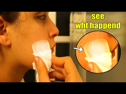 What will happen to your skin if you put an Ice Cube on Your face! Here’s what happens TO YOUR SKIN