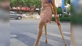 An Amazing Girl With An Amputated Leg With A Smile Builds A Bridge Of Hope#Amputee#Crutches #Amazing