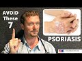 PSORIASIS (AVOID These 7 Things) 2022