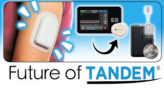 Tandem's Future: A Tubeless Pump, Mobi & Dexcom G7 Integration