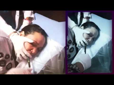 مناظير الجهاز الهضمى