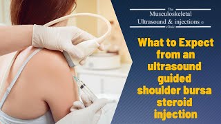 What To Expcet From An Ultrasound Guided Shoulder Bursitis Steroid Injection