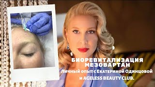 Биоревитализация лица, шеи и декольте Мезовартан / Meso-Warthon, Mesoeye глаза. Личный опыт до после Биоревитализация лица, шеи и декольте Мезовартан / Meso-Warthon, Mesoeye глаза. Личный опыт до после