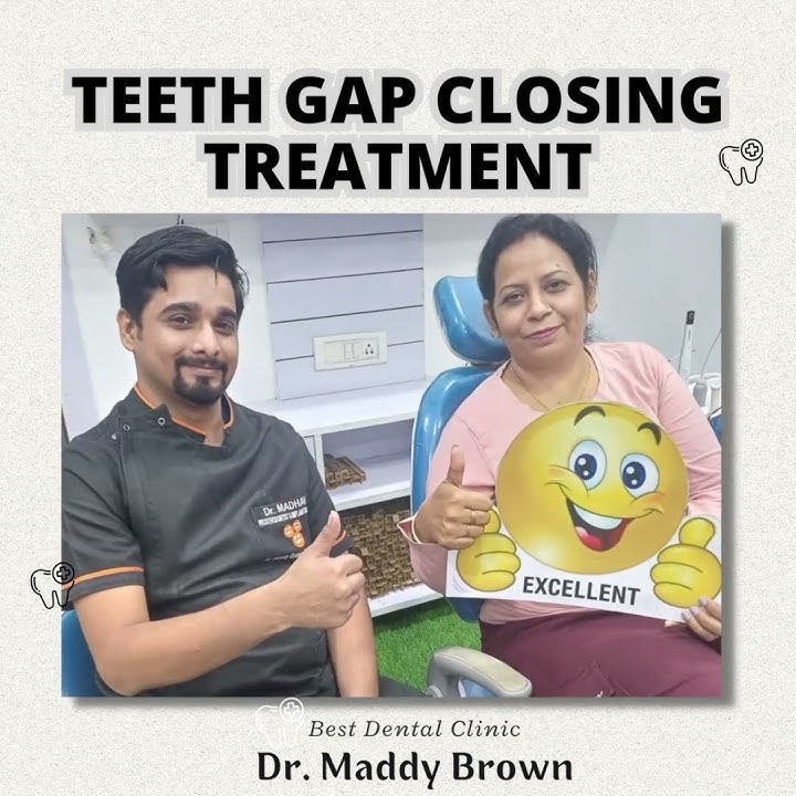 teeth gap closing treatment with veneers (Dr maddy brown) #teethgapmakeover