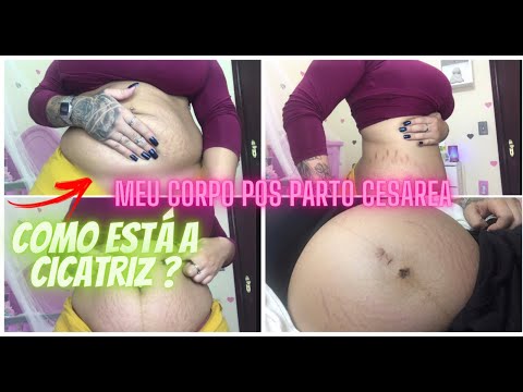 Vídeo: Reshetova Mostrou A Foto Pós-parto De Uma Figura Em Bicicletas