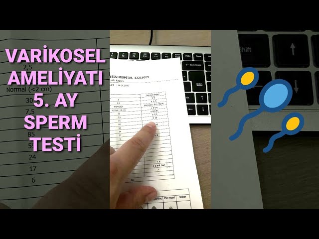 Erotik filmlarni onlayn tomosha qiling