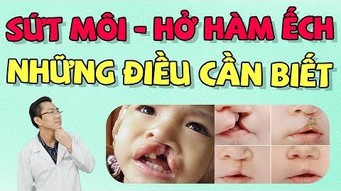 Sứt Môi Hở Hàm Ếch Là Gì | Phương Pháp Điều Trị Hiệu Quả