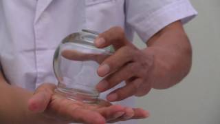 Chinese Glass Cupping Therapy - How to Create Suction Using Fire