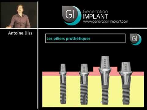 Le lexique implantaire : de l'implant à la prothèse